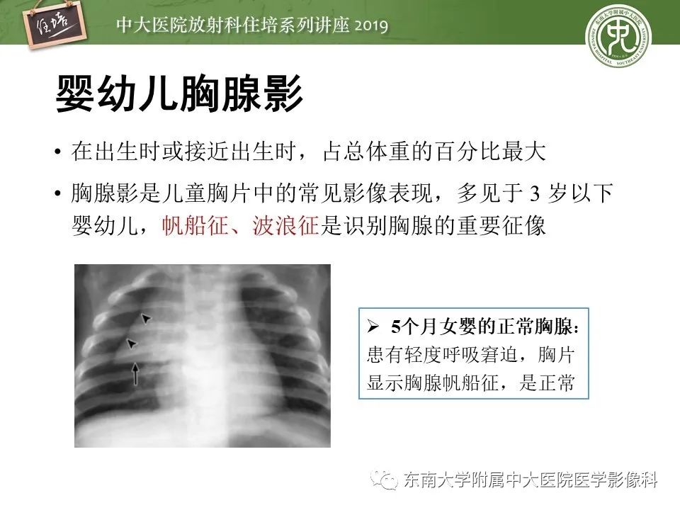 【PPT】胸腺上皮性肿瘤的影像诊断及鉴别
