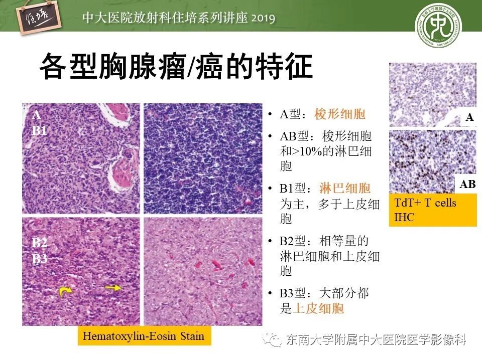 【PPT】胸腺上皮性肿瘤的影像诊断及鉴别