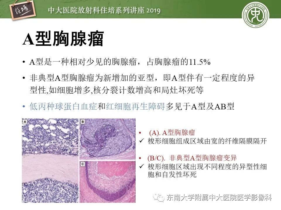 【PPT】胸腺上皮性肿瘤的影像诊断及鉴别