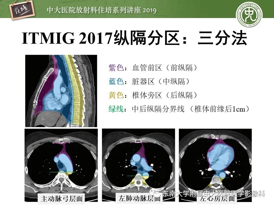 【PPT】胸腺上皮性肿瘤的影像诊断及鉴别
