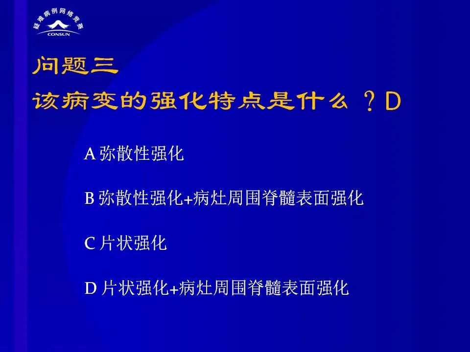 【病例】脊髓节细胞胶质瘤1例MR影像解析 【病例】脊髓节细胞胶质瘤1例MR影像解析