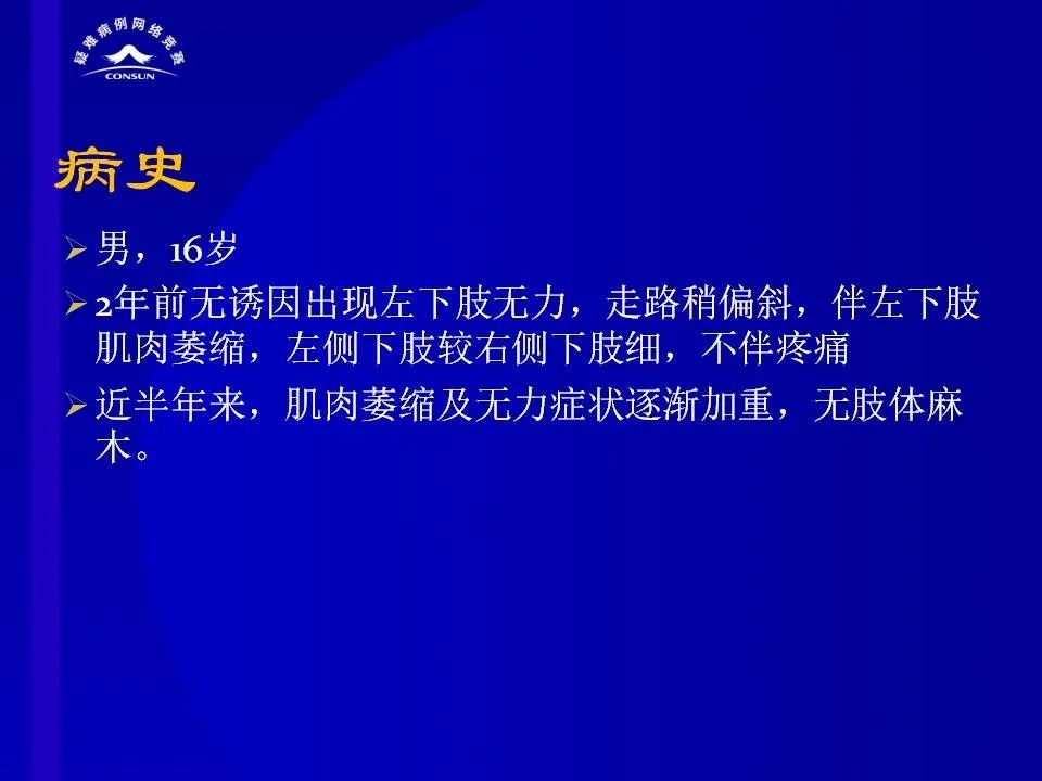 【病例】脊髓节细胞胶质瘤1例MR影像解析