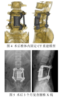 图4.png