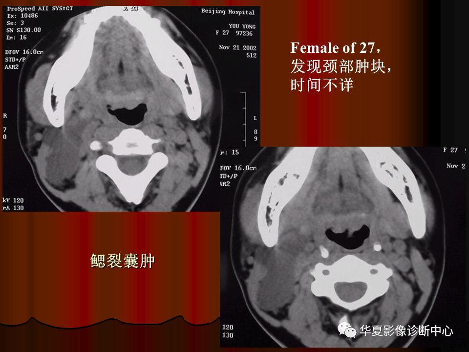 【PPT】口腔颌面部CT诊断
