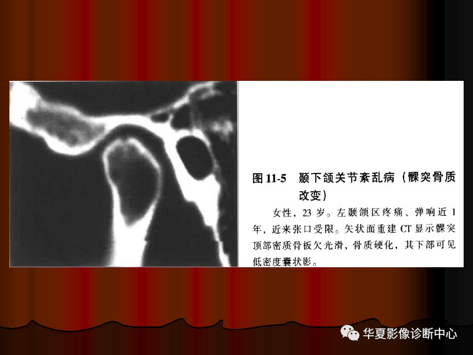 【PPT】口腔颌面部CT诊断