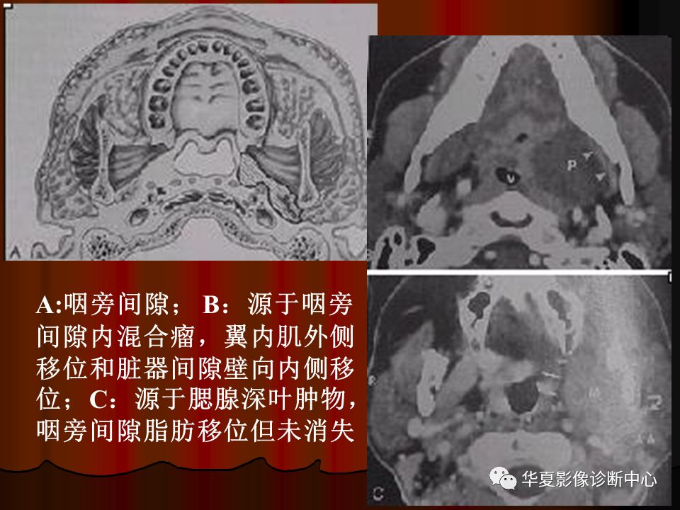 【PPT】口腔颌面部CT诊断