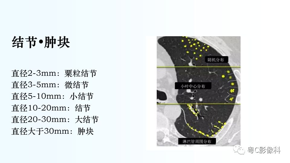 【PPT】儿童胸部影像诊断*基础病变