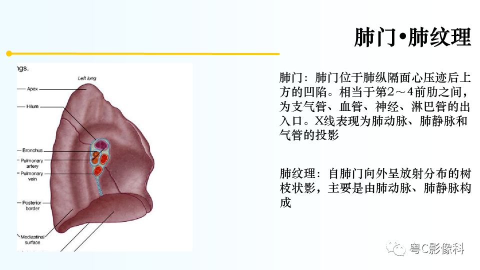 【PPT】儿童胸部影像诊断*基础病变