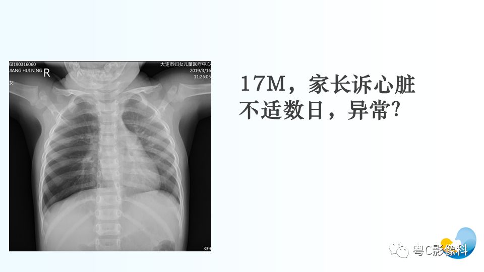 【PPT】儿童胸部影像诊断*基础病变