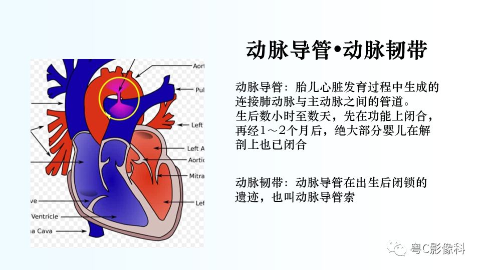【PPT】儿童胸部影像诊断*基础病变