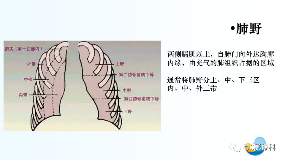 【PPT】儿童胸部影像诊断*基础病变