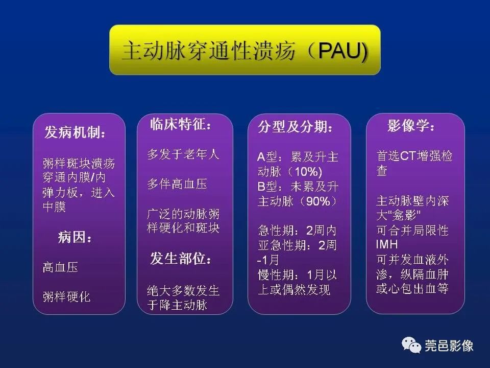 【PPT】急性主动脉综合征