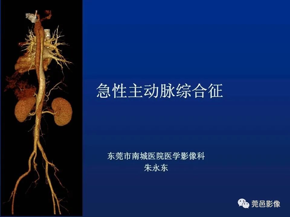 【PPT】急性主动脉综合征