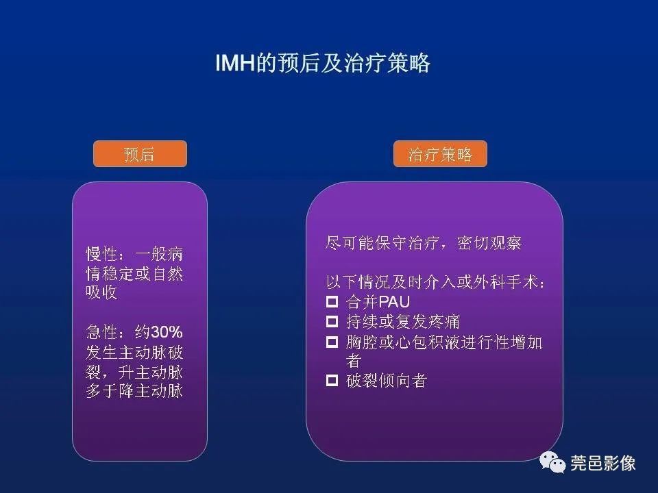 【PPT】急性主动脉综合征
