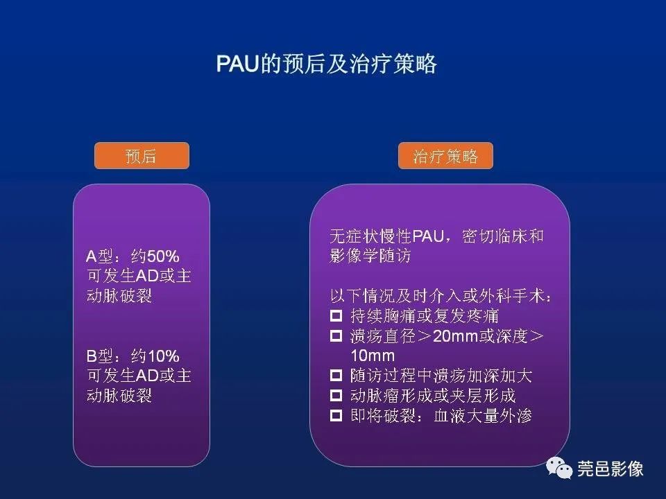 【PPT】急性主动脉综合征