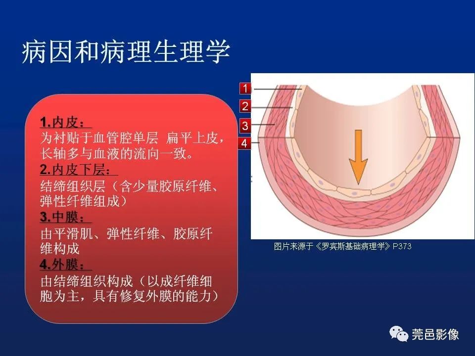 【PPT】急性主动脉综合征