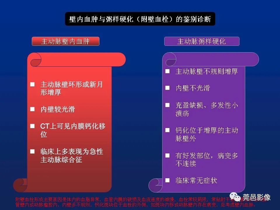【PPT】急性主动脉综合征