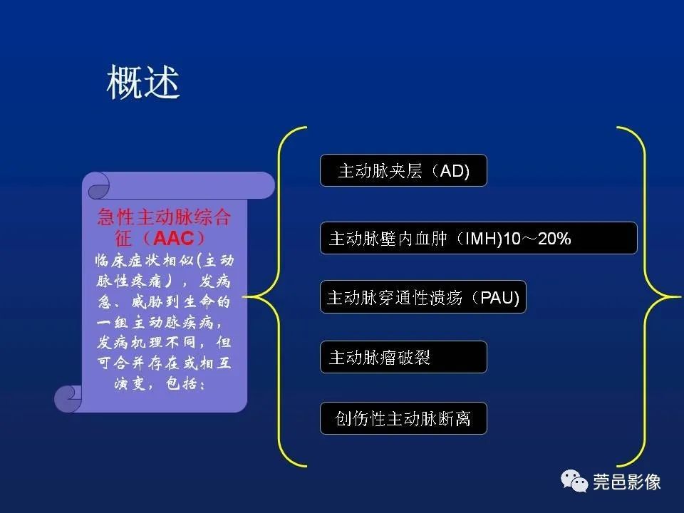 【PPT】急性主动脉综合征