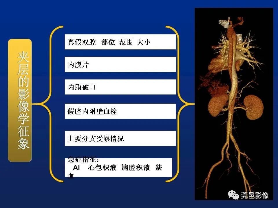 【PPT】急性主动脉综合征