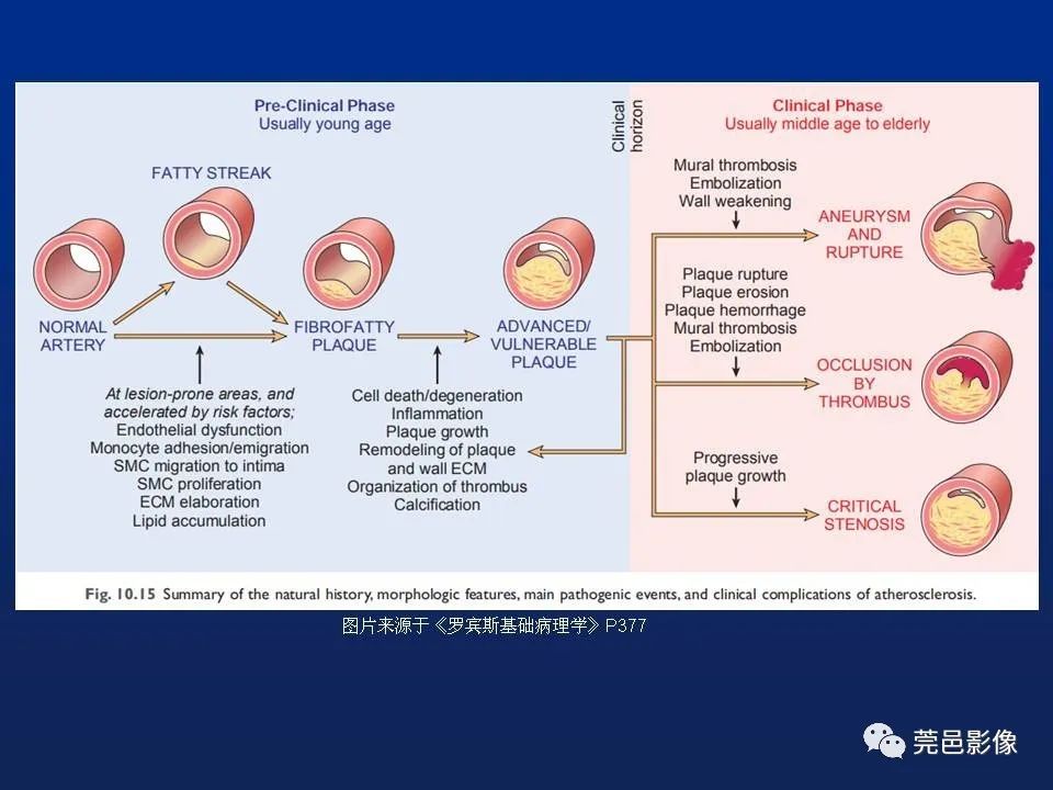 【PPT】急性主动脉综合征
