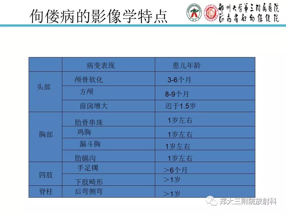 【PPT】佝偻病的影像特点