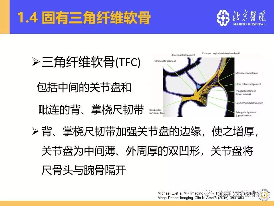【PPT】三角纤维软骨复合体(TFCC)损伤 【PPT】三角纤维软骨复合体(TFCC)损伤