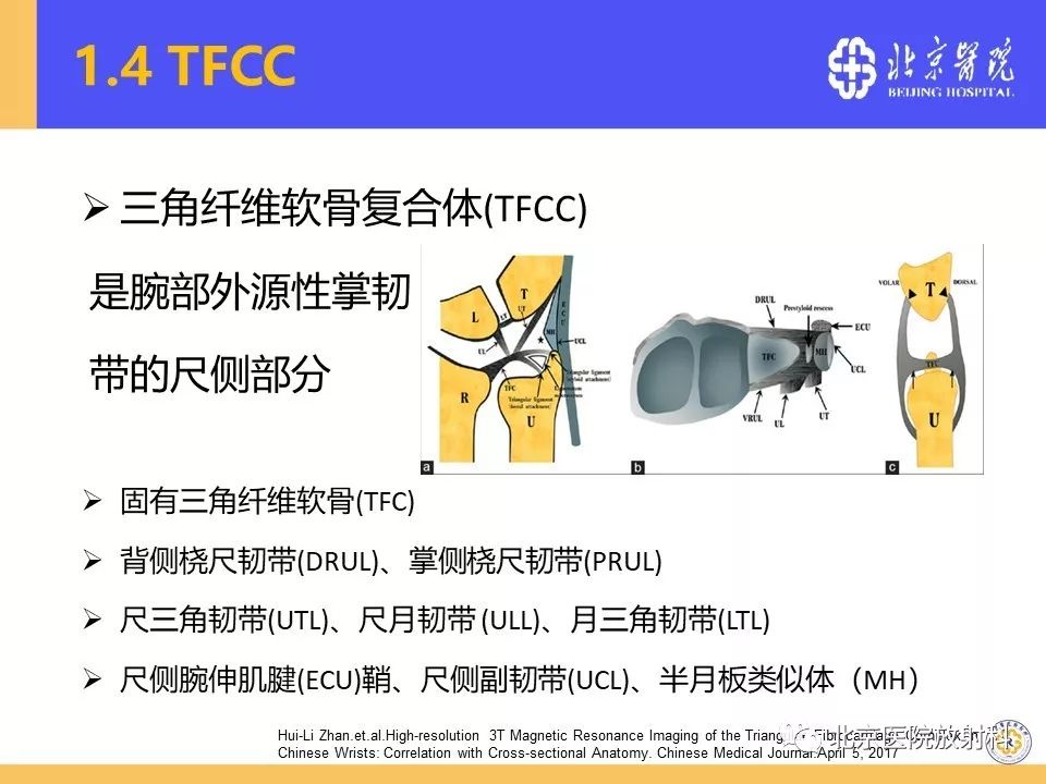 【PPT】三角纤维软骨复合体(TFCC)损伤 【PPT】三角纤维软骨复合体(TFCC)损伤