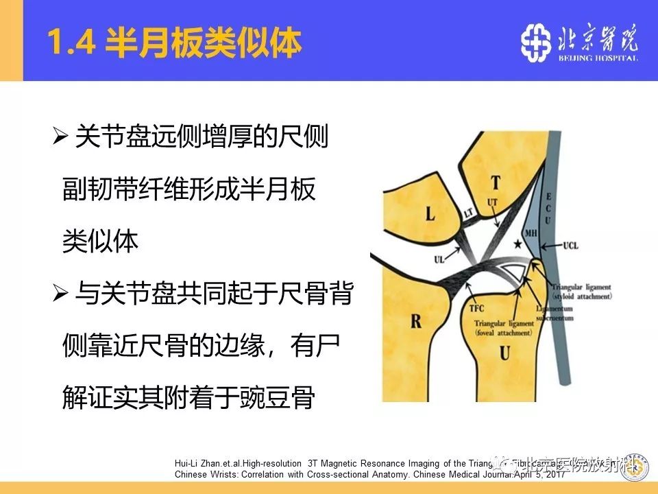 【PPT】三角纤维软骨复合体(TFCC)损伤 【PPT】三角纤维软骨复合体(TFCC)损伤