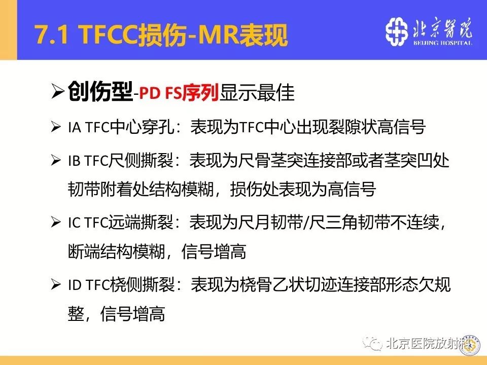 【PPT】三角纤维软骨复合体(TFCC)损伤 【PPT】三角纤维软骨复合体(TFCC)损伤