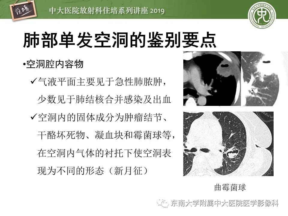 【PPT】肺空洞病变影像诊断及鉴别