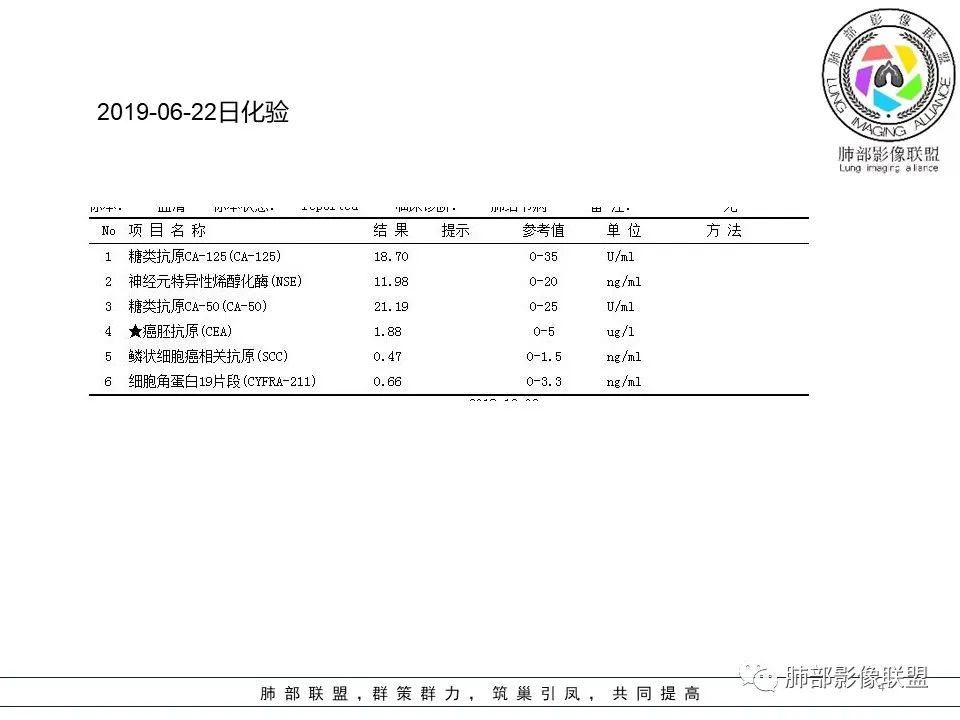【病例】左肺上叶腺癌1例CT影像讨论