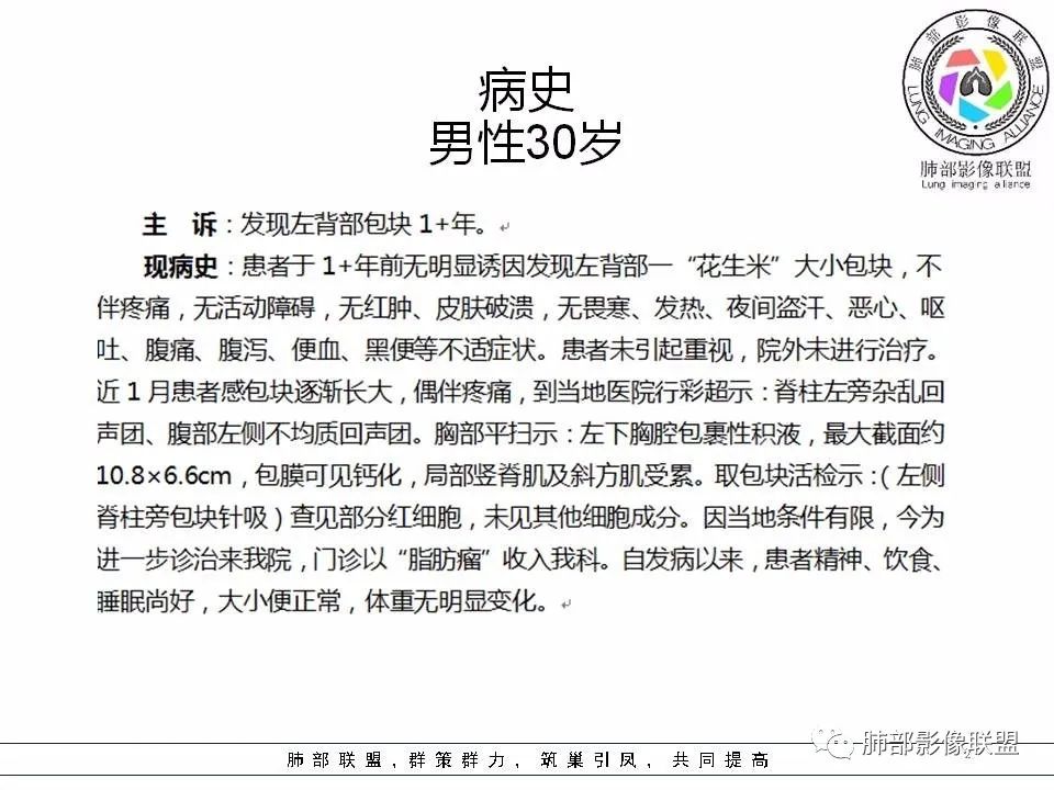 【病例】冬眠瘤一例影像讨论