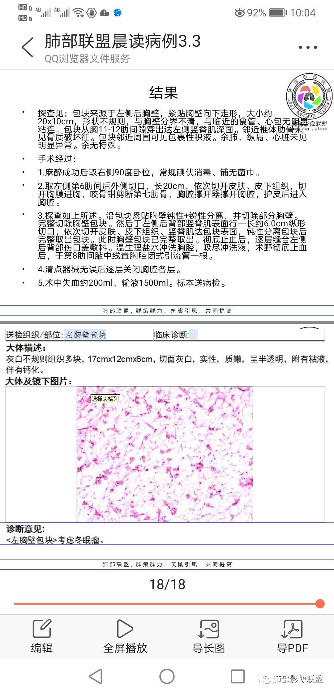 【病例】冬眠瘤一例影像讨论