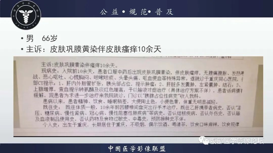 【病例】胰腺癌1例CT影像