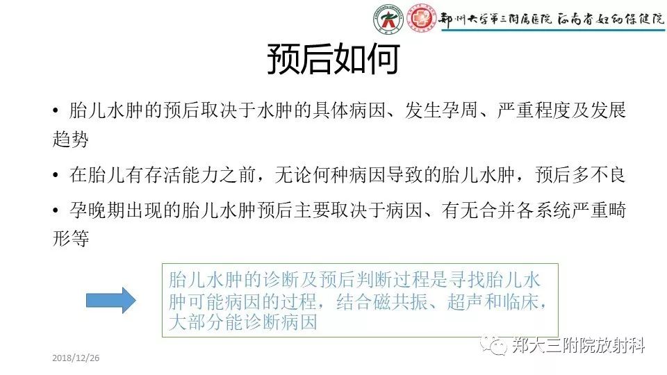【PPT】胎儿水肿综合征