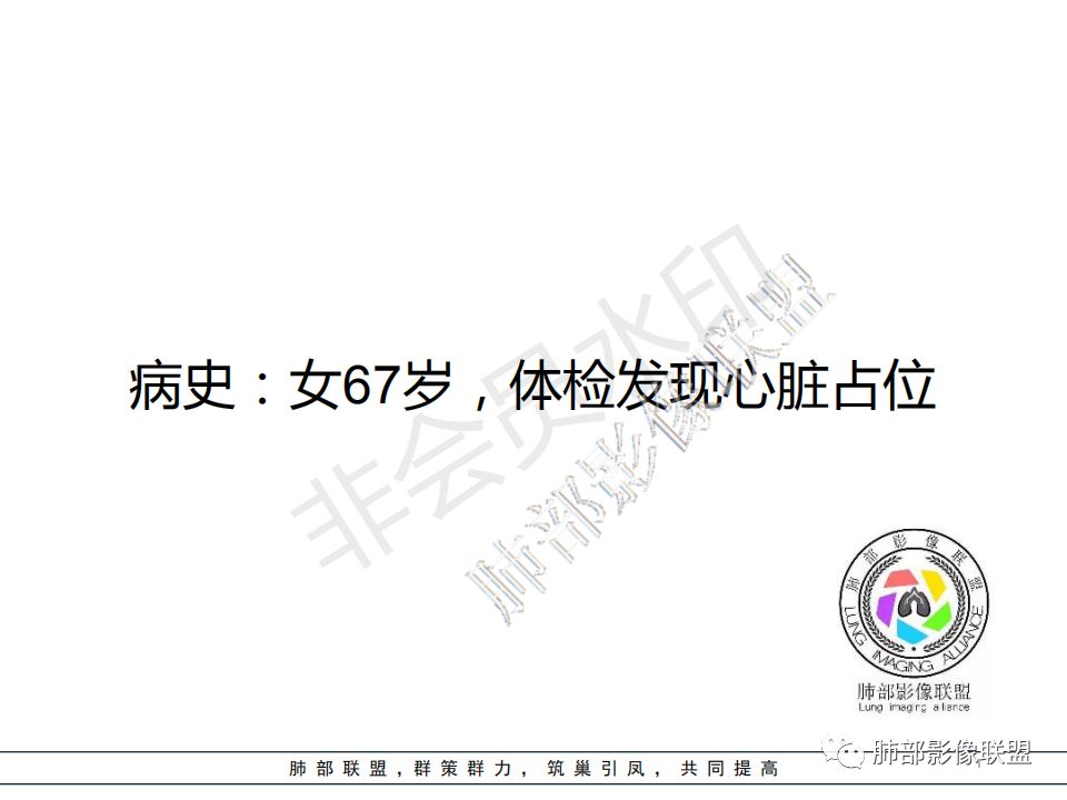 【病例】心包海绵状血管瘤1例CT影像