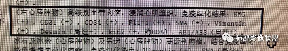 【病例】心脏血管肉瘤1例CT影像