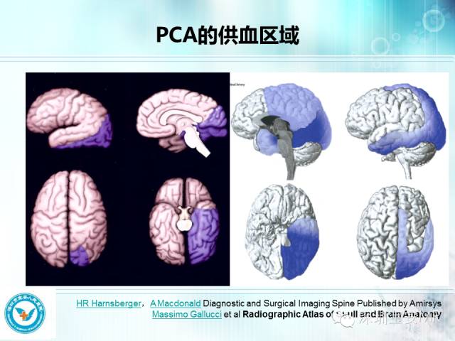 【PPT】颅内动脉供血区域解剖及临床影像