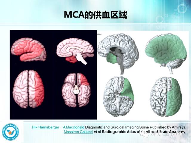 【PPT】颅内动脉供血区域解剖及临床影像