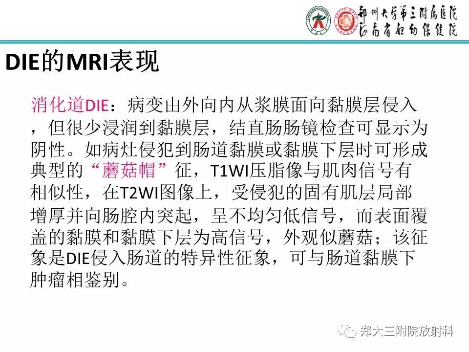 【病例】一例有内膜癌的子宫腺肌症MR