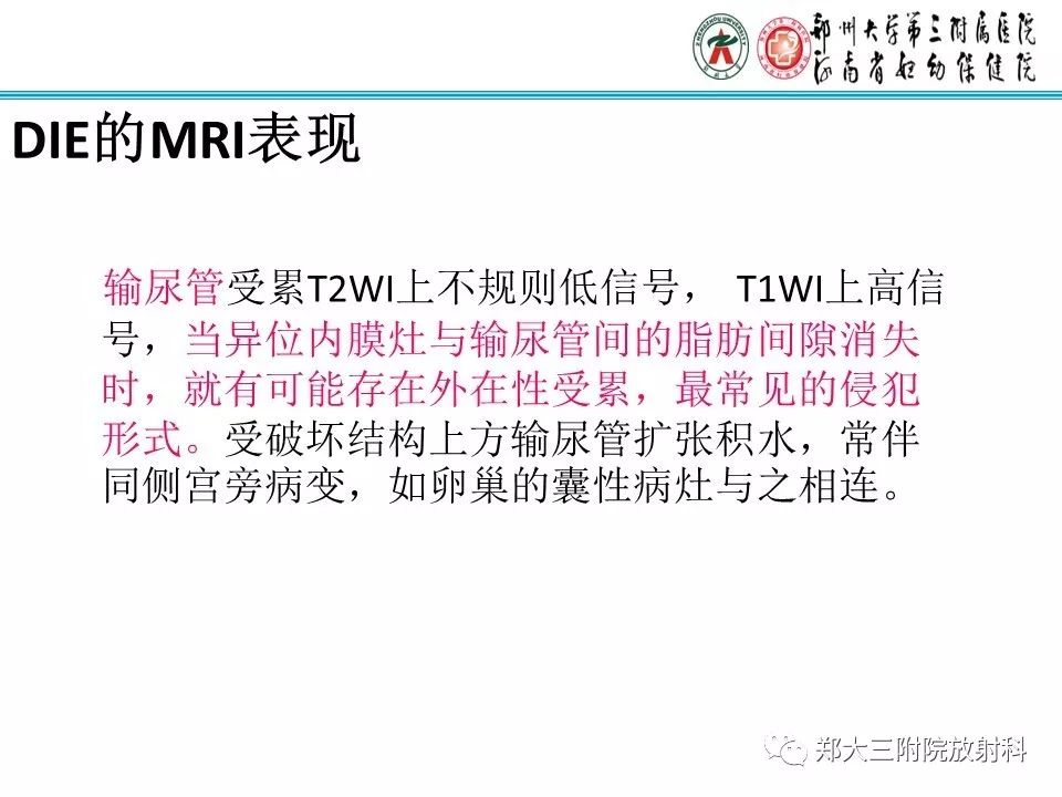【病例】一例有内膜癌的子宫腺肌症MR