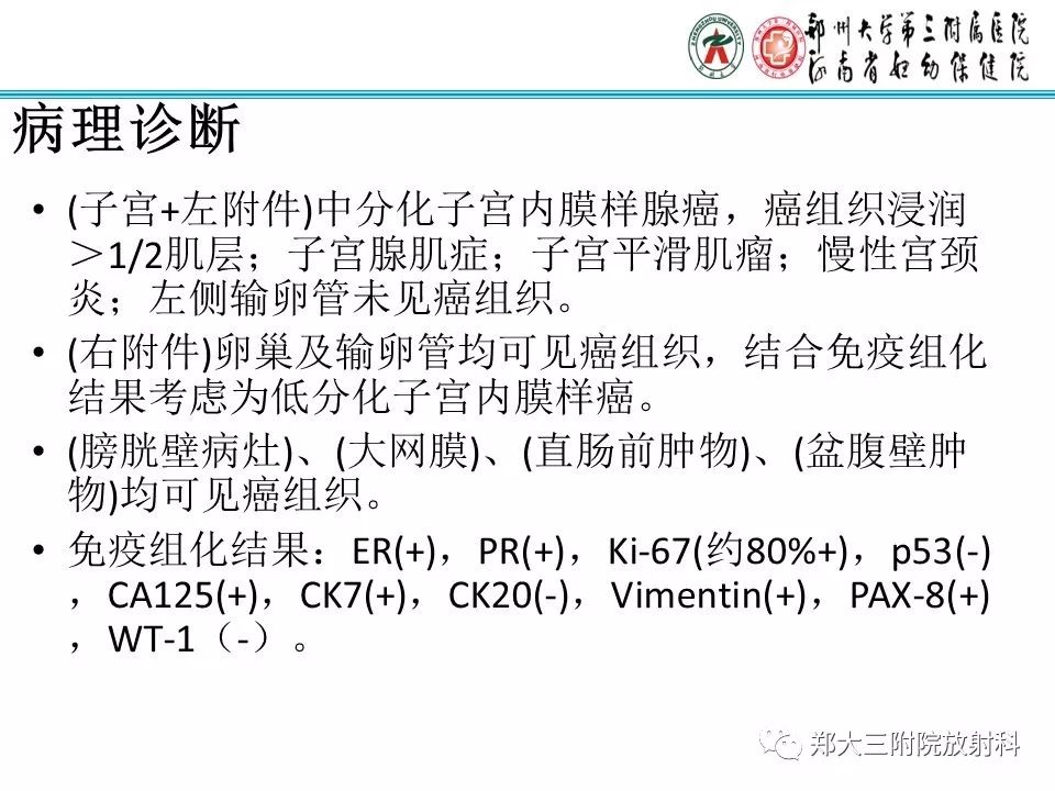 【病例】一例有内膜癌的子宫腺肌症MR