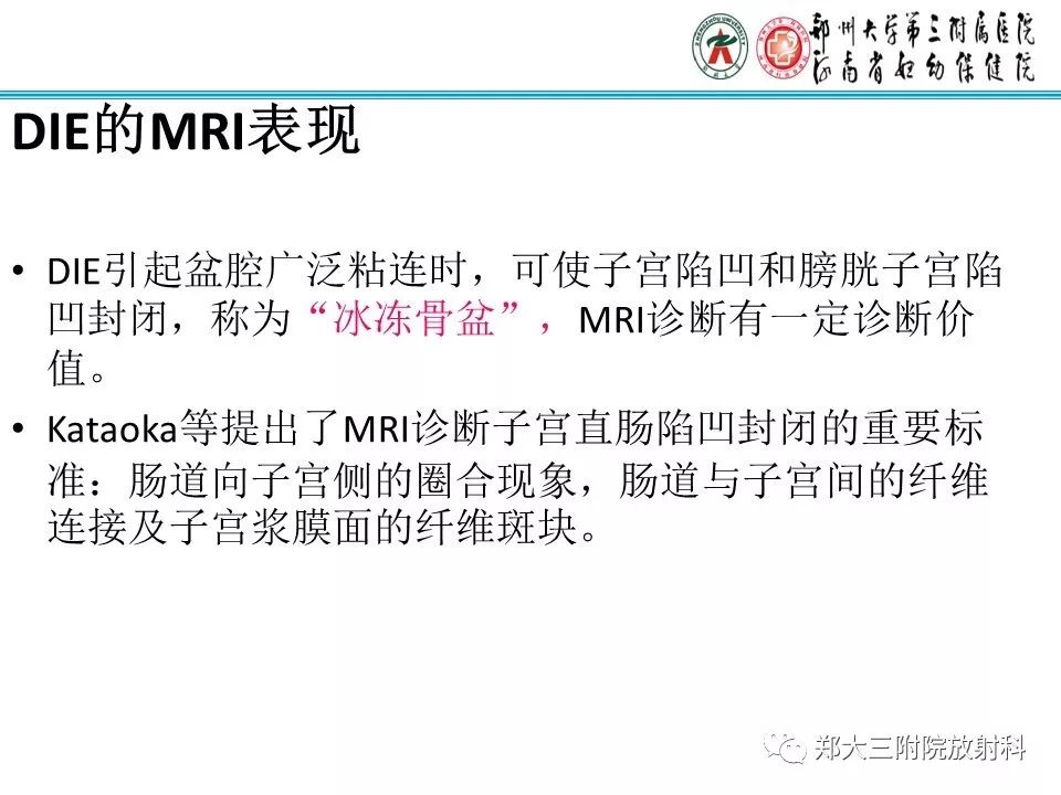【病例】一例有内膜癌的子宫腺肌症MR