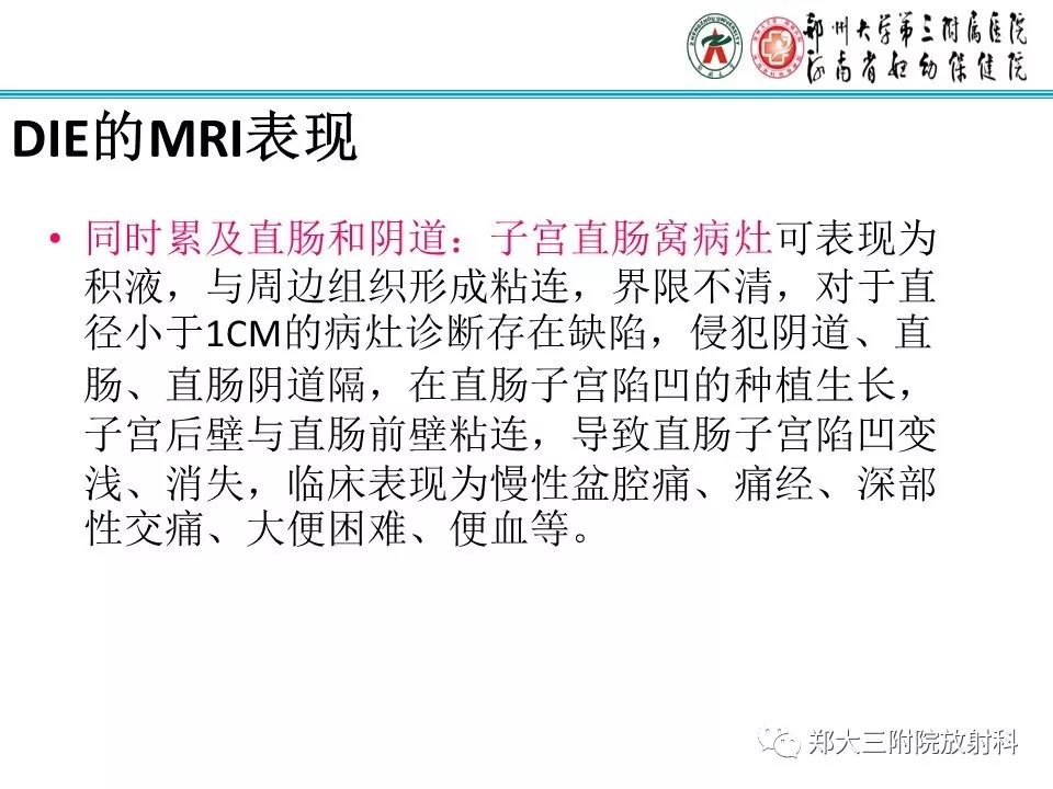 【病例】一例有内膜癌的子宫腺肌症MR