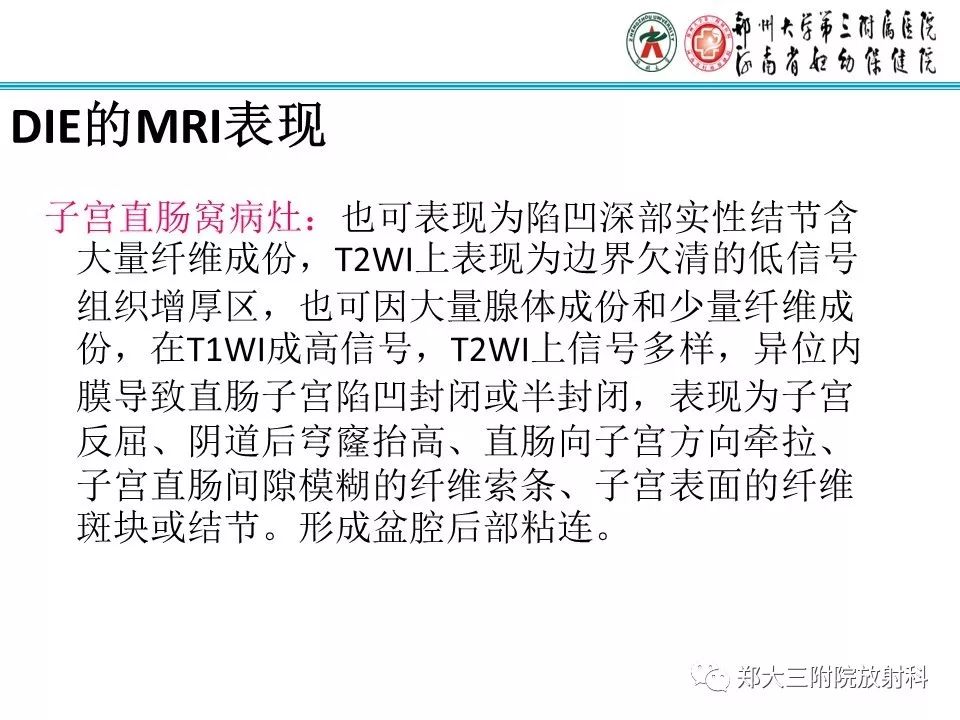 【病例】一例有内膜癌的子宫腺肌症MR