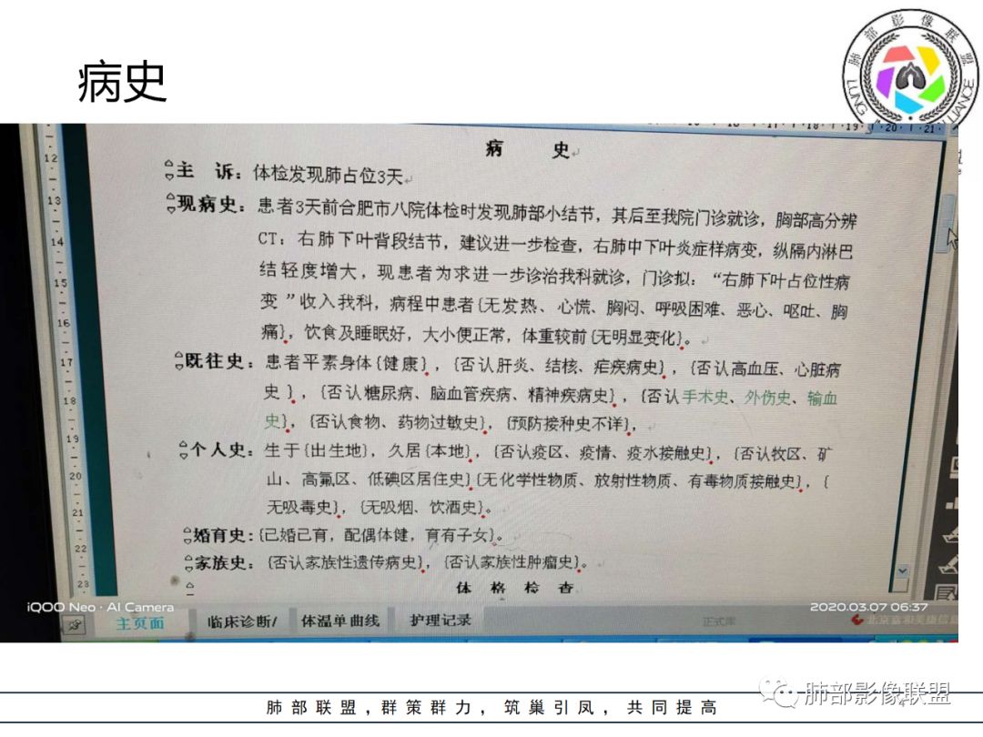 【病例】结核居然也能有晕征