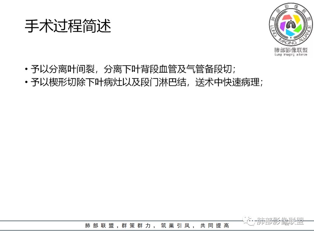 【病例】结核居然也能有晕征 【病例】结核居然也能有晕征