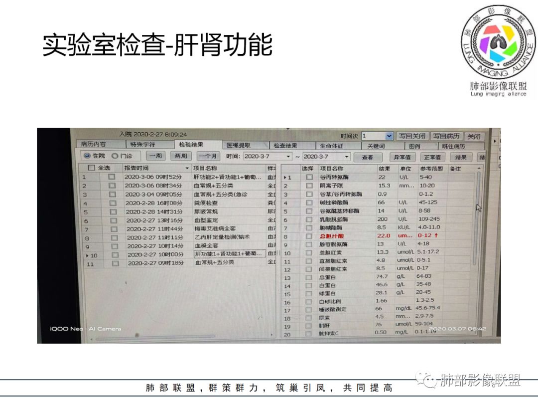 【病例】结核居然也能有晕征 【病例】结核居然也能有晕征