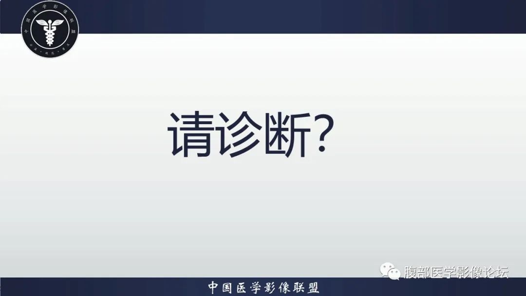 【病例】胰腺巨大淋巴结增生症(Castleman Disease)1例CT影像