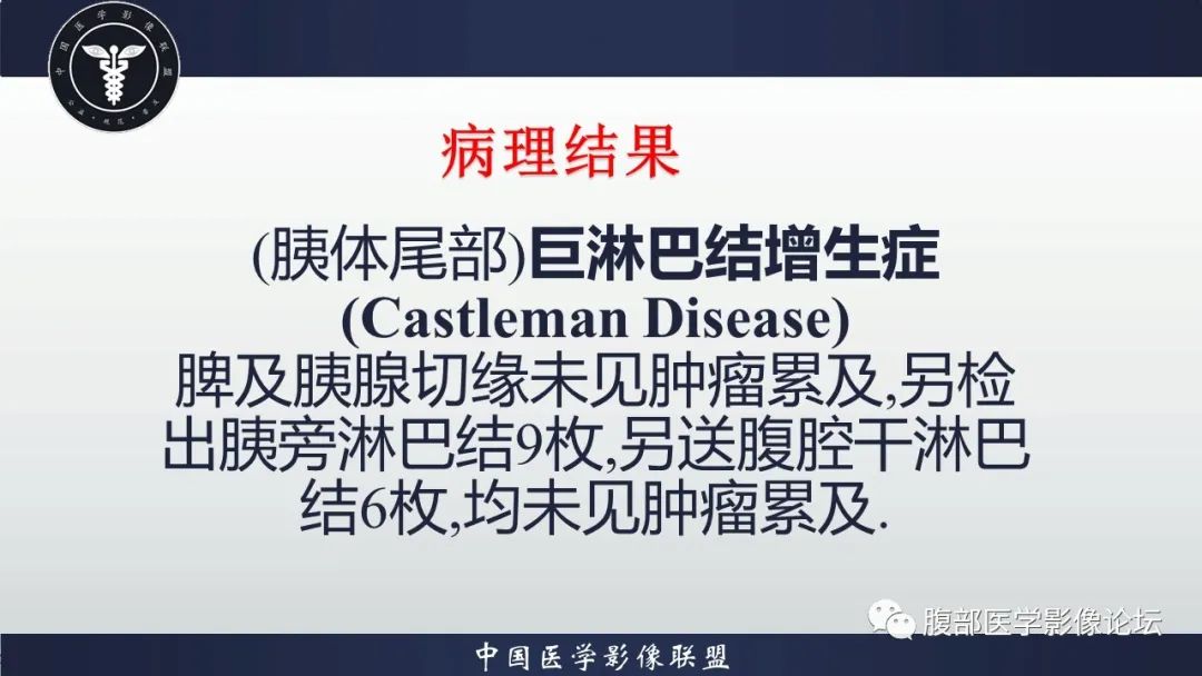 【病例】胰腺巨大淋巴结增生症(Castleman Disease)1例CT影像